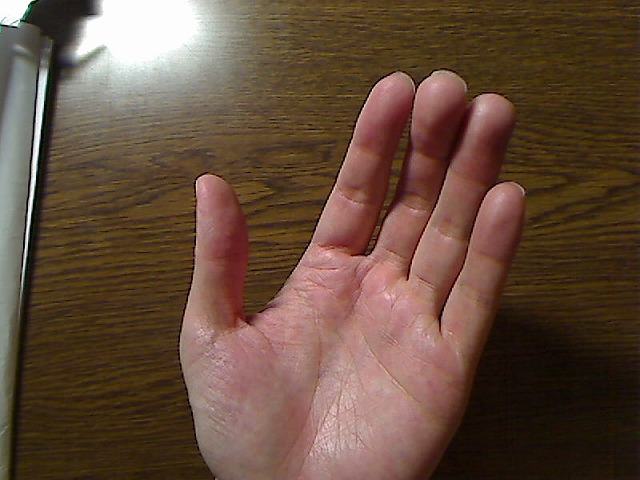 手のひら側、親指以外の4本の付け根が膨らんでいる。