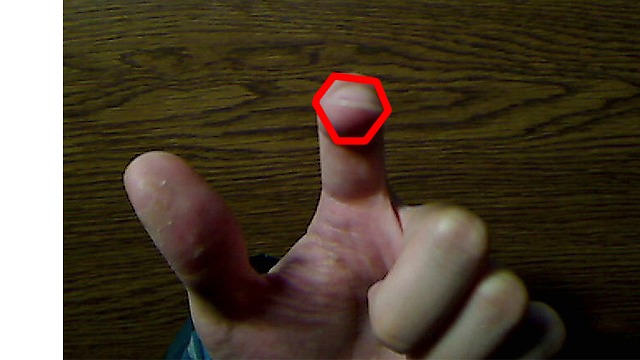 指を真上から見た写真。六角形の形。