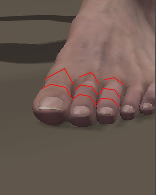 足の指の断面形状。